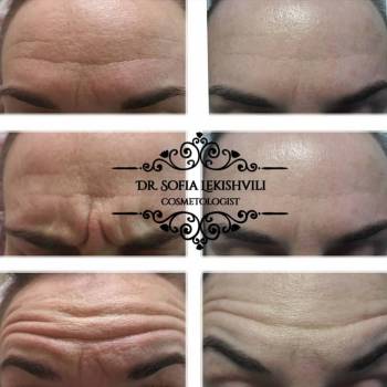 Фото с портфолио София 