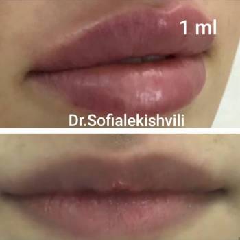 Фото с портфолио София 