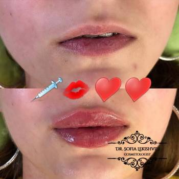 Фото с портфолио София 