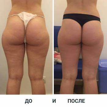 Студия эстетики тела, Киев Фото - 5