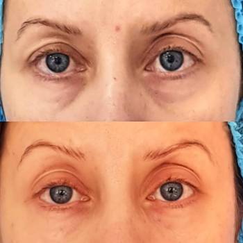 ANACOSMA, Киев Фото - 19