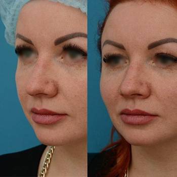 ANACOSMA, Киев Фото - 17