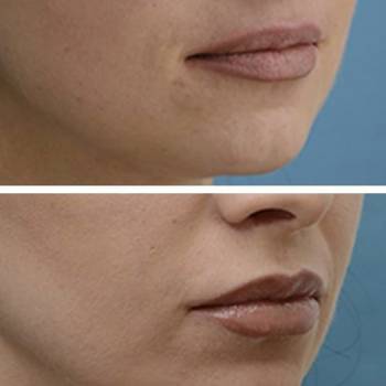 ANACOSMA, Киев Фото - 16