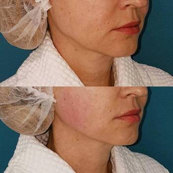 ANACOSMA, Киев Фото - 15