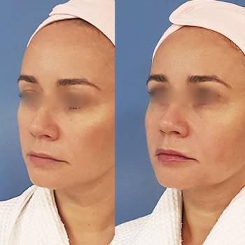 ANACOSMA, Киев Фото - 14