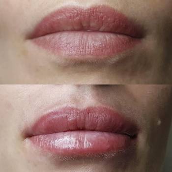 ANACOSMA, Киев Фото - 11