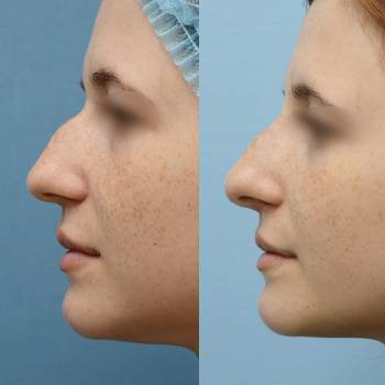 ANACOSMA, Киев Фото - 2