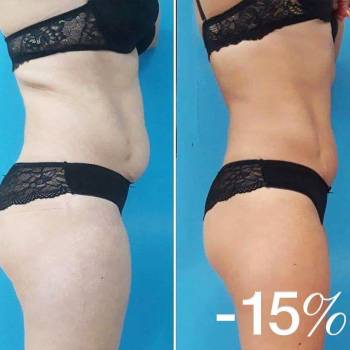 ANACOSMA, Киев Фото - 9