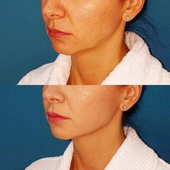 ANACOSMA, Киев Фото - 8