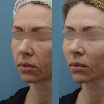 ANACOSMA, Киев Фото - 5