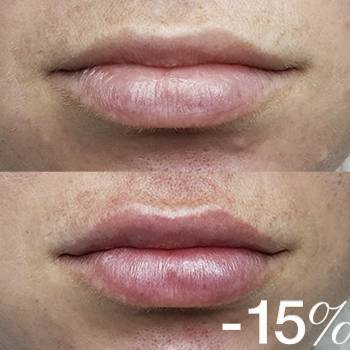 ANACOSMA, Киев Фото - 4