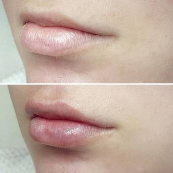 ANACOSMA, Киев Фото - 3