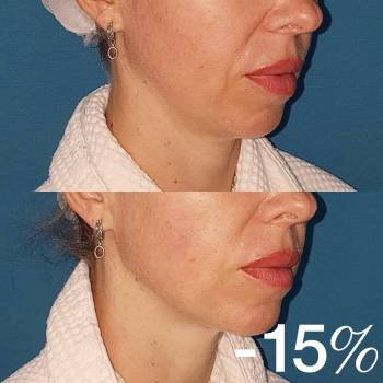 ANACOSMA, Киев Фото - 22