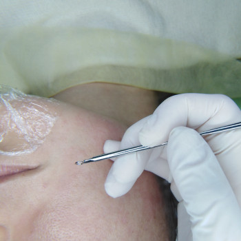 Комбінована чистка обличчя
                    Массажист Юлія Киев