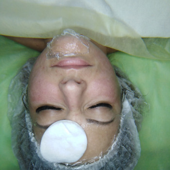 Комбінована чистка обличчя
                    Массажист Юлія Киев