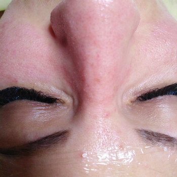  после чистки