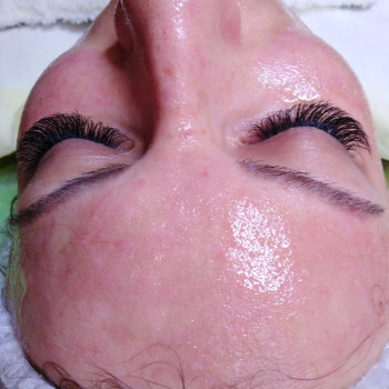 После чистки и карбокси - на лице маска с биозолотом