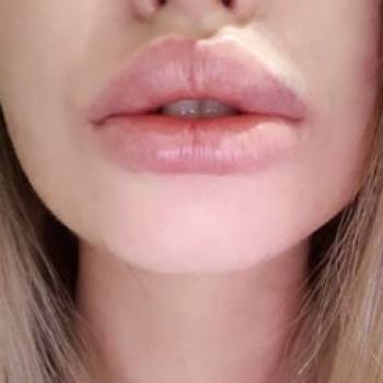 Фото с портфолио Touch Light Cosmetology