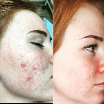 Наталия Сидоренко, Днепр Фото - 24