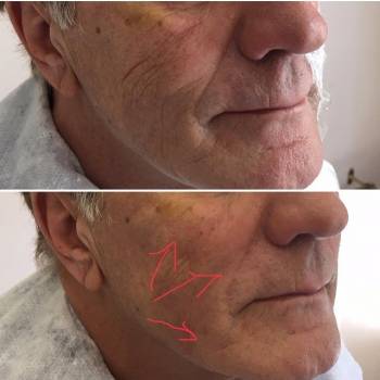 Наталия Сидоренко, Днепр Фото - 29