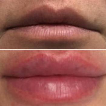 Наталия Сидоренко, Днепр Фото - 33