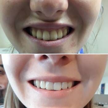 Наталия Сидоренко, Днепр Фото - 2