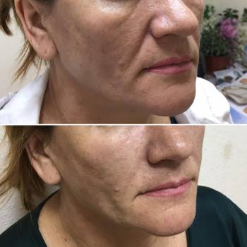 Наталия Сидоренко, Днепр Фото - 13