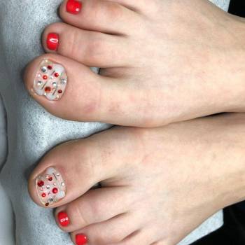 Медицинский педикюр, педикюр и лечение вросшего ногтя