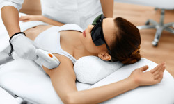 Лазерна епіляція Косметологический центр Fine Line Ивано-Франковск