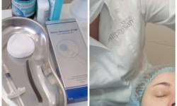 Мезотерапия лица Косметолог Виктория Князева Харьков