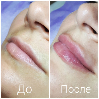 Фото с портфолио Essence of Beauty