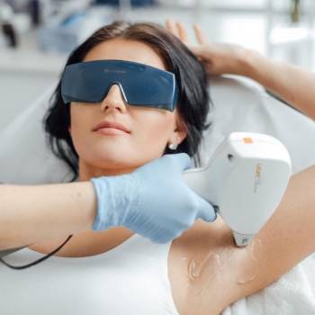 Лазерная эпиляция