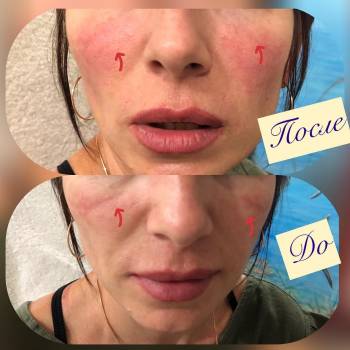 Start Estet, Маріуполь Фото - 5