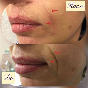 Start Estet, Маріуполь Фото - 6