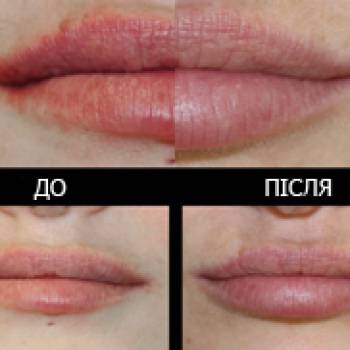 Elle, Мелітополь Фото - 5