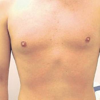 Lazer Beauty, Ровно Фото - 6