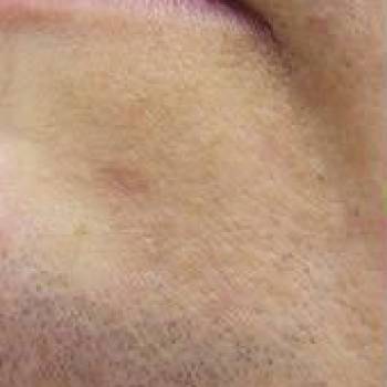 Lazer Beauty, Суми Фото - 5