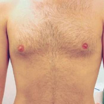 Lazer Beauty, Тернопіль Фото - 5