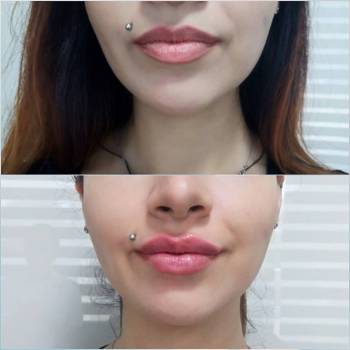 Альона Димитрова, Одеса Фото - 5