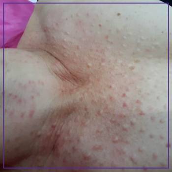 New Laser, Хмельницкий Фото - 5