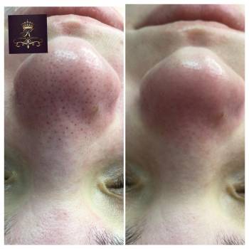 Фото с портфолио New Life