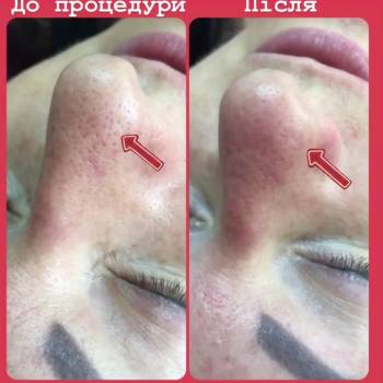 Фото с портфолио New Life