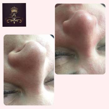 Фото с портфолио New Life