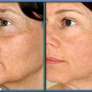 ЛК-естетик, Черкассы Фото - 5