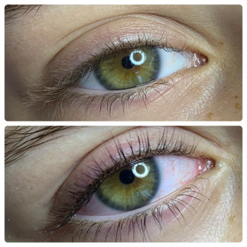 Фото из портфолио косметолога Лейла Гараева (Одесса)