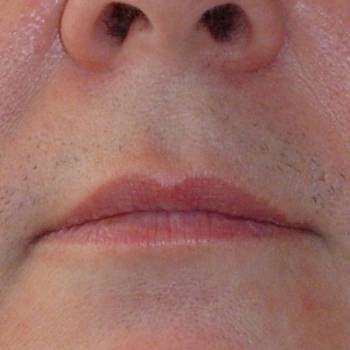 Lazer Beauty, Полтава Фото - 5