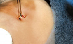 Пірсинг Врач-косметолог Неля Константиновна Киев