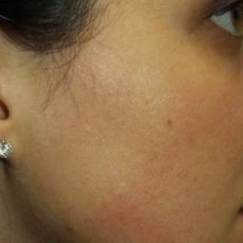 Lazer Beauty, Кременчуг Фото - 5