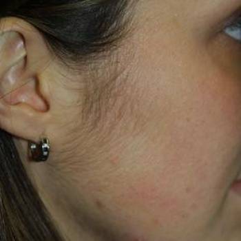 Lazer Beauty, Кременчуг Фото - 6