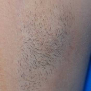 Lazer Beauty, Краматорск Фото - 5